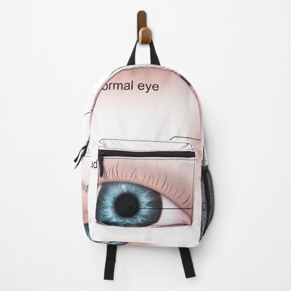 Item preview, STK701348H-Cataract in the human eye compared to a normal eye. designed and sold by StocktrekImages.