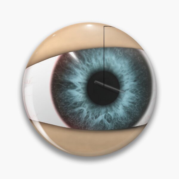 Item preview, STK701351H-Corneal abrasion in the human eye. designed and sold by StocktrekImages.