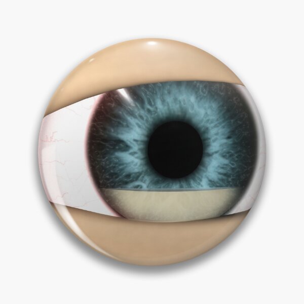 Item preview, STK701353H-Dndophthalmitis on the interior of the eye. designed and sold by StocktrekImages.
