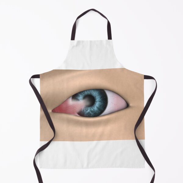Item preview, STK701356H-Pterygium in the human eye. designed and sold by StocktrekImages.