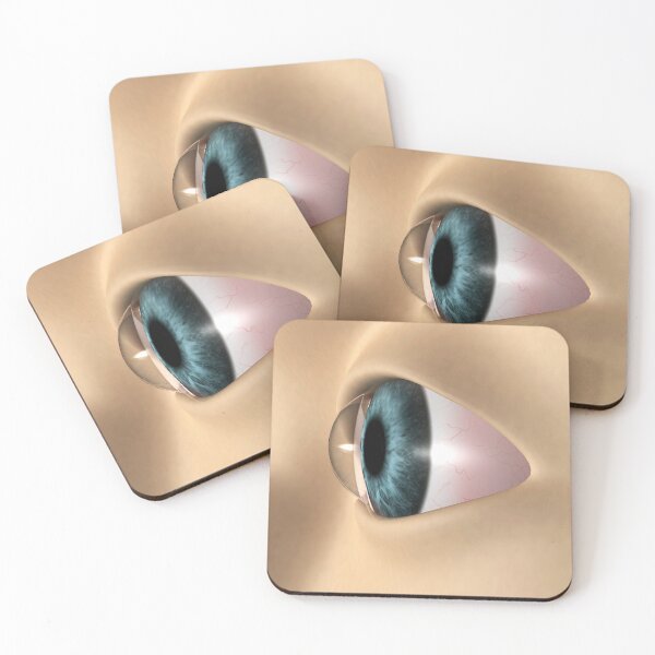 Item preview, STK701358H-Keratoconus in the eye. designed and sold by StocktrekImages.