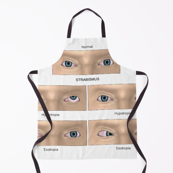 Item preview, STK701359H-Strabismus diagram. designed and sold by StocktrekImages.