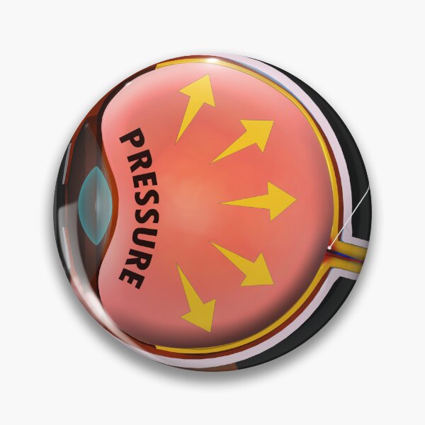 Item preview, STK701360H-Increased pressure in the eyeball leading to glaucoma. designed and sold by StocktrekImages.