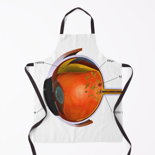 Item preview, STK701361H-Macular degeneration. designed and sold by StocktrekImages.