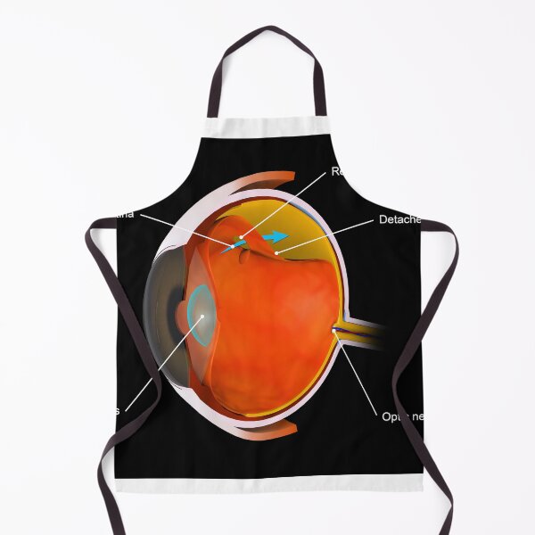 Item preview, STK701365H-A detached retina. designed and sold by StocktrekImages.