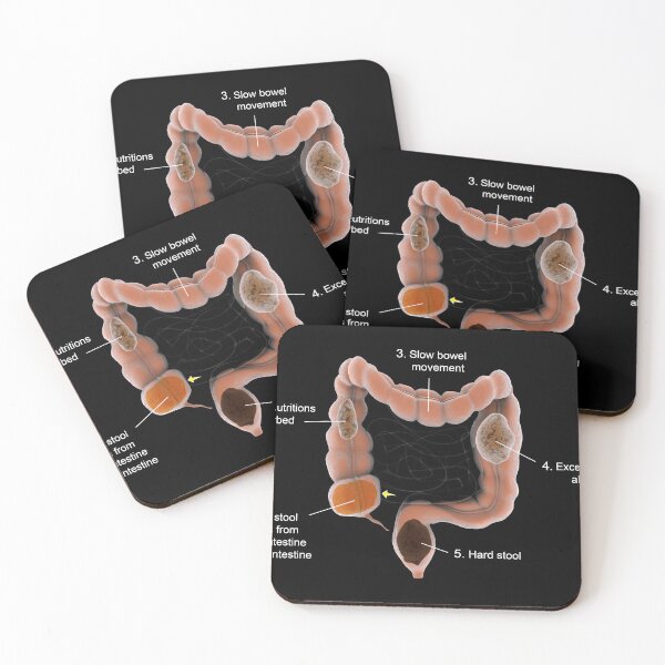 Item preview, STK701378H-Constipation in the human intestines. designed and sold by StocktrekImages.