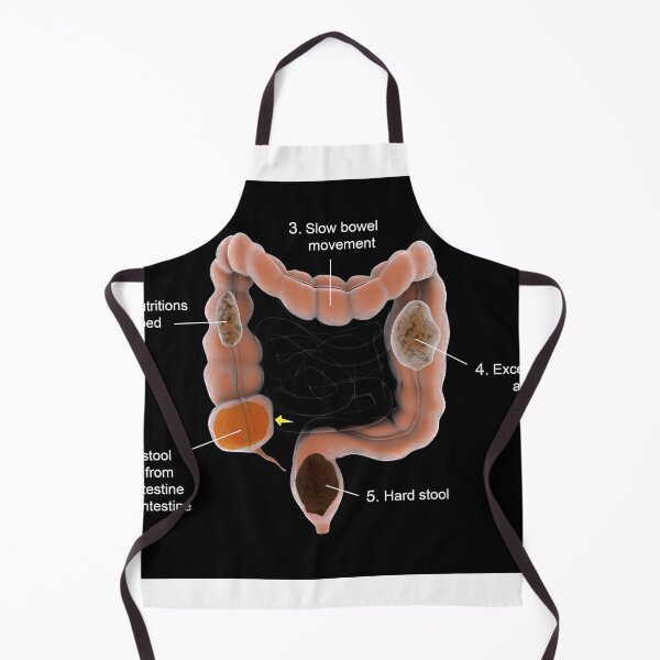 Item preview, STK701378H-Constipation in the human intestines. designed and sold by StocktrekImages.