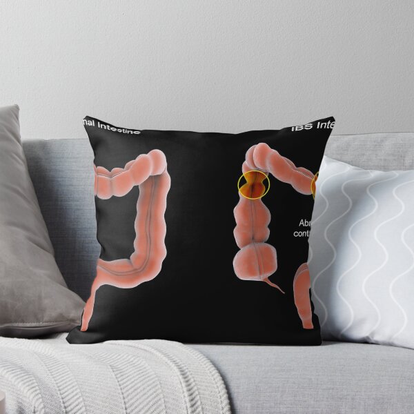 Item preview, STK701380H-Normal vs. abnormal bowel contractions. designed and sold by StocktrekImages.