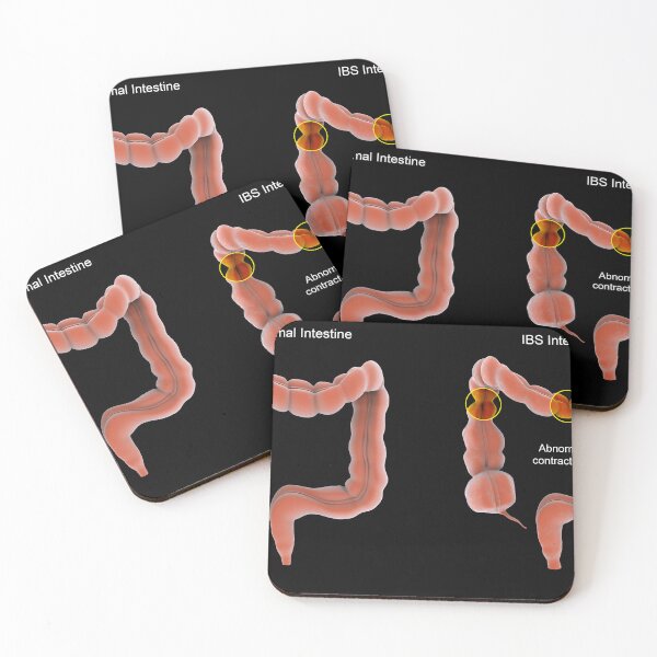 Item preview, STK701380H-Normal vs. abnormal bowel contractions. designed and sold by StocktrekImages.