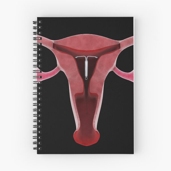 Item preview, STK701381H-An intrauterine device in position inside the female uterus. designed and sold by StocktrekImages.