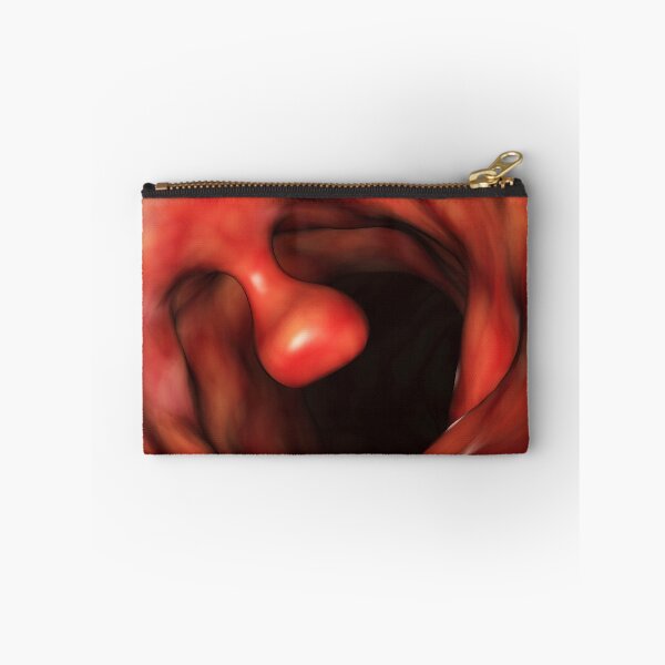 Item preview, STK701391H-Close-up of a colon polyp. designed and sold by StocktrekImages.