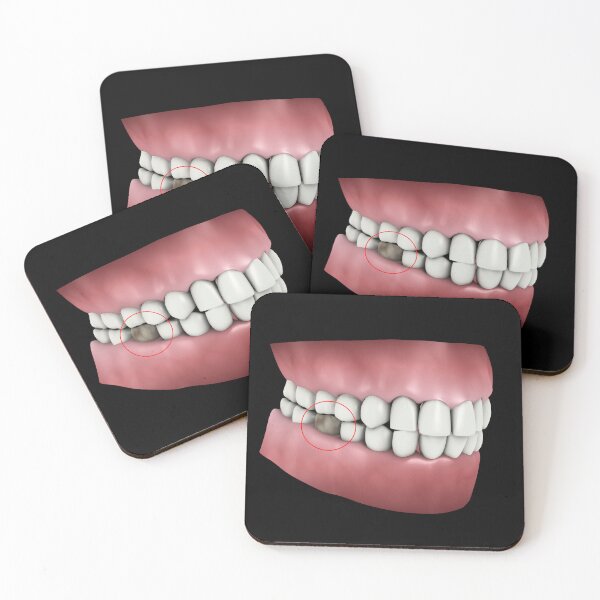 Item preview, STK701393H-Tooth cavity. designed and sold by StocktrekImages.