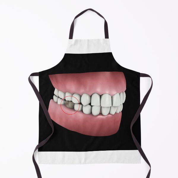 Item preview, STK701393H-Tooth cavity. designed and sold by StocktrekImages.