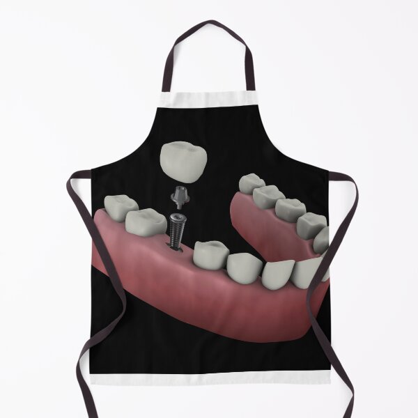 Item preview, STK701394H-Tooth implant. designed and sold by StocktrekImages.