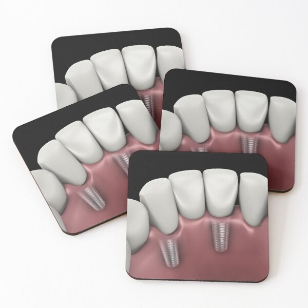 Item preview, STK701395H-Tooth implant. designed and sold by StocktrekImages.