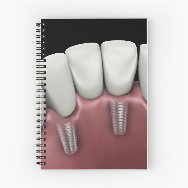 Item preview, STK701395H-Tooth implant. designed and sold by StocktrekImages.