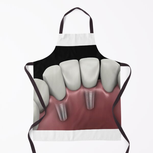 Item preview, STK701395H-Tooth implant. designed and sold by StocktrekImages.