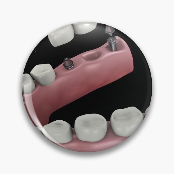 Item preview, STK701396H-A dental bridge. designed and sold by StocktrekImages.
