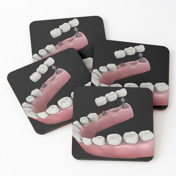 Item preview, STK701396H-A dental bridge. designed and sold by StocktrekImages.