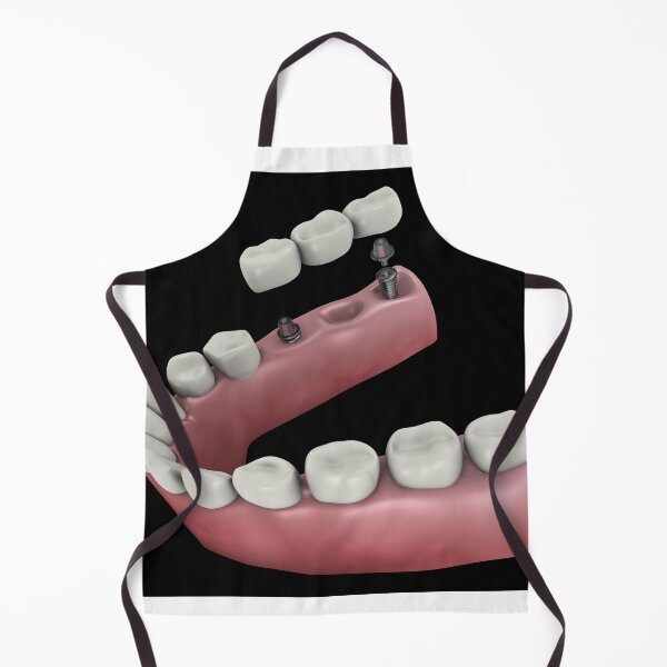 Item preview, STK701396H-A dental bridge. designed and sold by StocktrekImages.