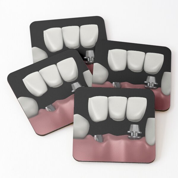 Item preview, STK701398H-A dental bridge. designed and sold by StocktrekImages.