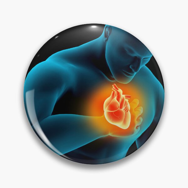 Item preview, STK701405H-Medical illustration of a heart attack. designed and sold by StocktrekImages.
