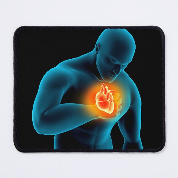 Item preview, STK701405H-Medical illustration of a heart attack. designed and sold by StocktrekImages.