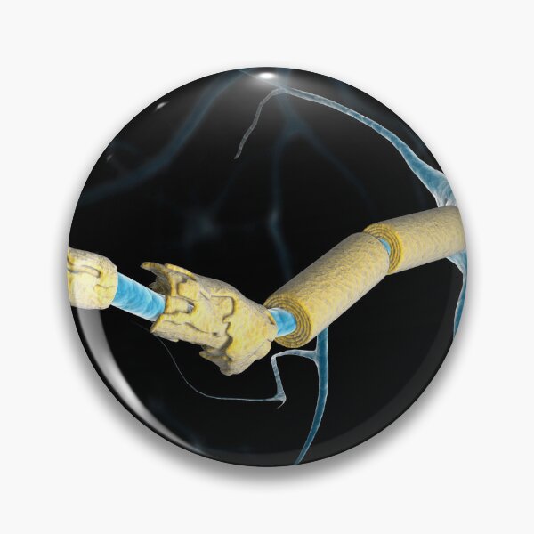 Item preview, STK701417H-A multiple sclerosis neuron. designed and sold by StocktrekImages.