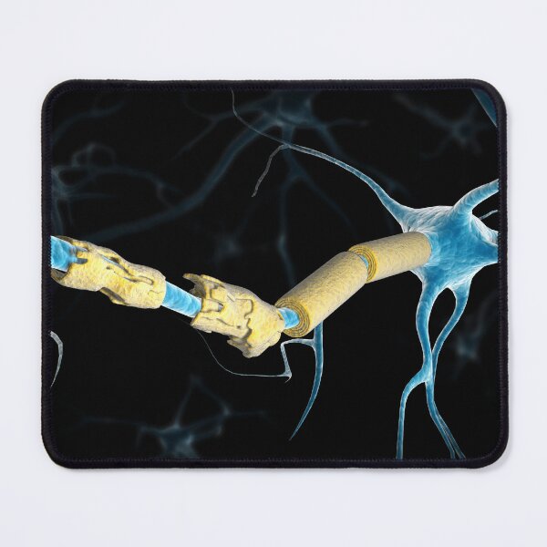 Item preview, STK701417H-A multiple sclerosis neuron. designed and sold by StocktrekImages.