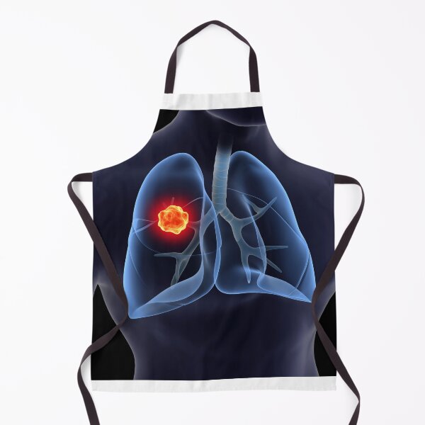 Item preview, STK701433H-Lung cancer inside the human lungs. designed and sold by StocktrekImages.