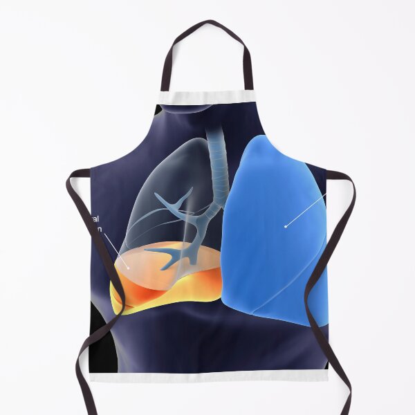 Item preview, STK701435H-Pleurisy in the human lungs. designed and sold by StocktrekImages.