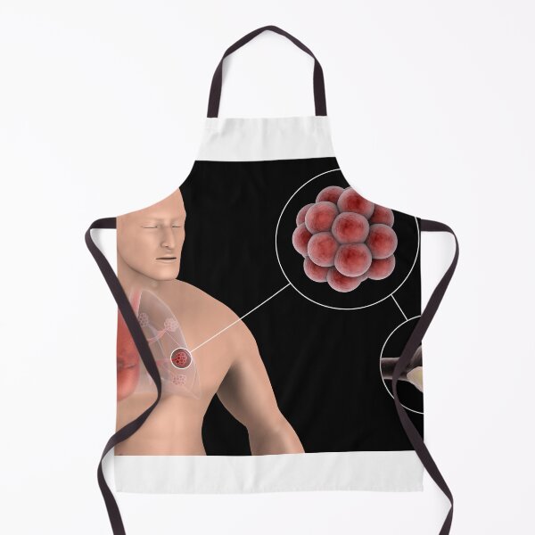 Item preview, STK701439H-Pneumonia in the alveolus of human lungs. designed and sold by StocktrekImages.