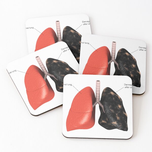 Item preview, STK701441H-Healthy lung vs. a smoker's lung. designed and sold by StocktrekImages.