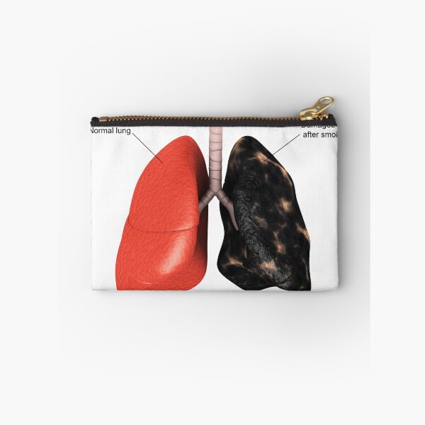 Item preview, STK701441H-Healthy lung vs. a smoker's lung. designed and sold by StocktrekImages.