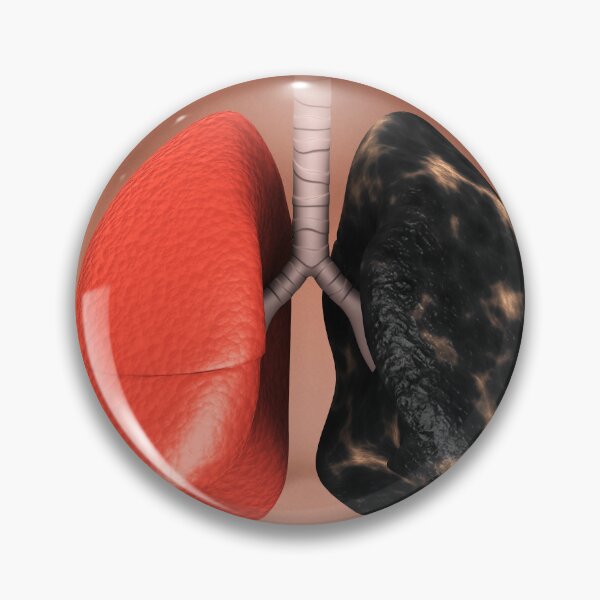 Item preview, STK701442H-Healthy lung vs. a smoker's lung. designed and sold by StocktrekImages.