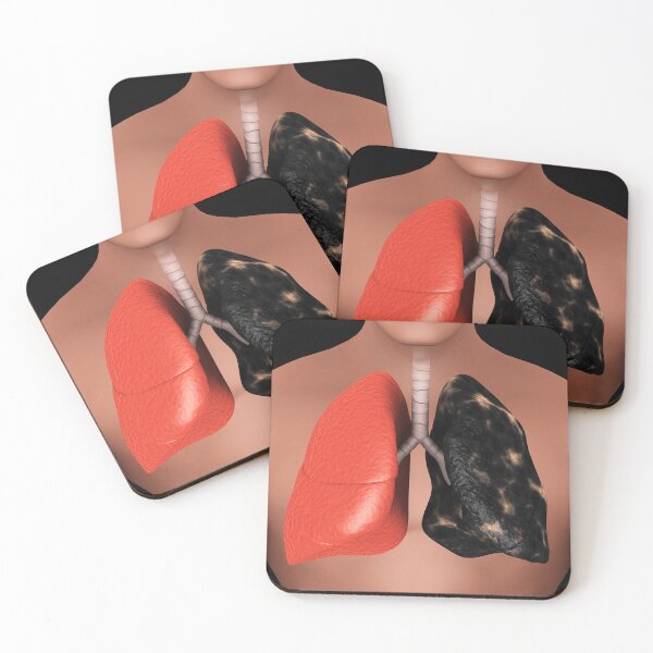 Item preview, STK701442H-Healthy lung vs. a smoker's lung. designed and sold by StocktrekImages.