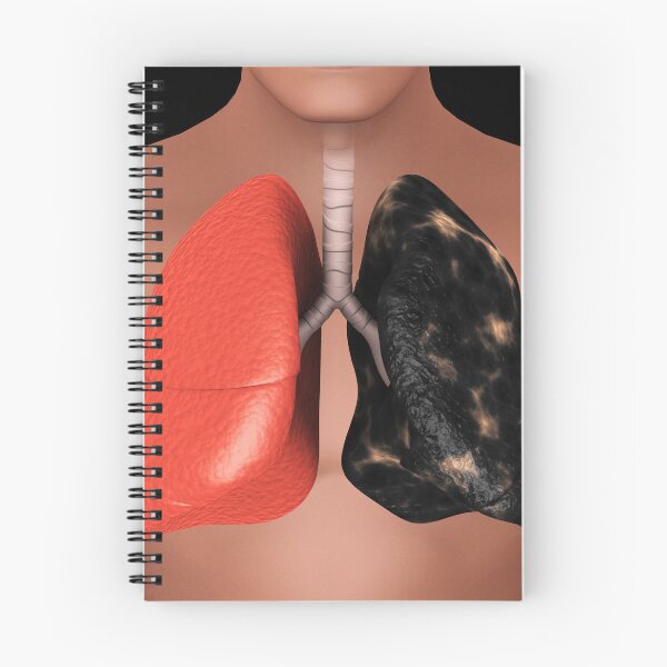 Item preview, STK701442H-Healthy lung vs. a smoker's lung. designed and sold by StocktrekImages.