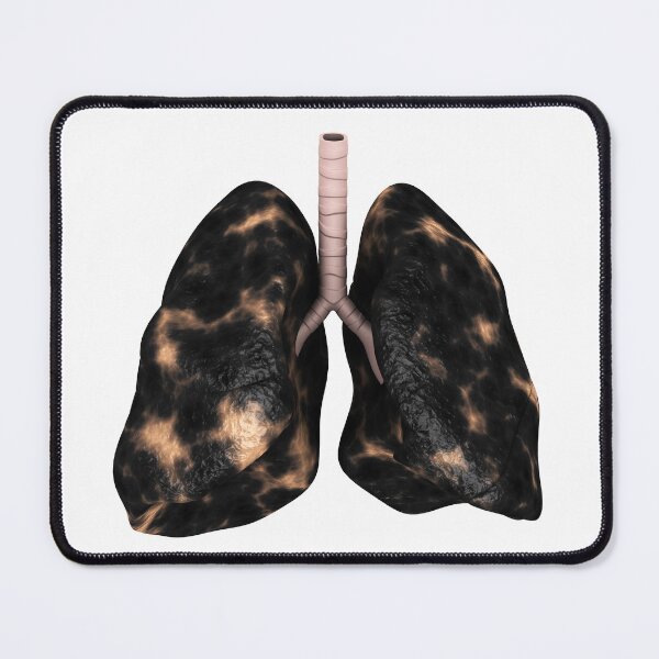 Item preview, STK701443H-Smoker lungs illustration. designed and sold by StocktrekImages.