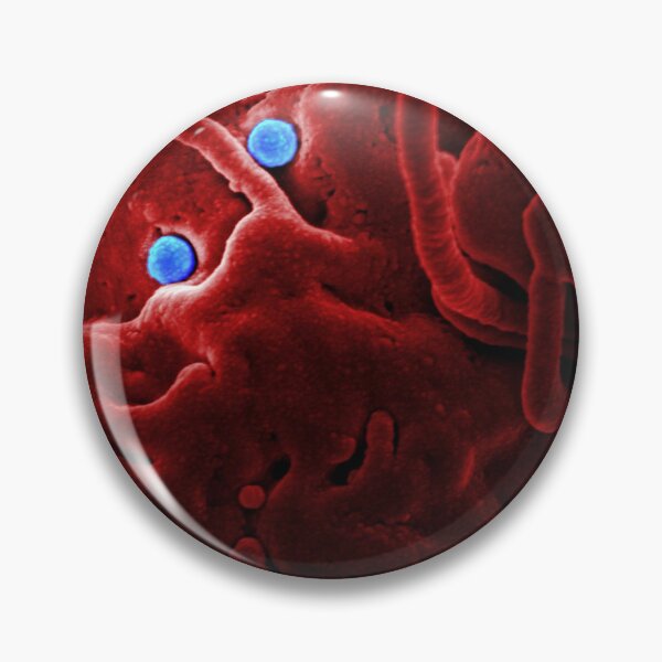 Item preview, STK701457H-MERS-CoV viral particles on the surface of a came epithelial cell. designed and sold by StocktrekImages.