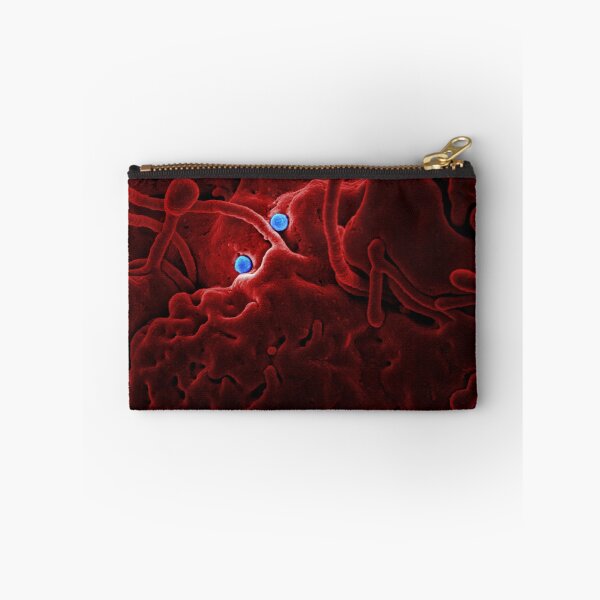 Item preview, STK701457H-MERS-CoV viral particles on the surface of a came epithelial cell. designed and sold by StocktrekImages.