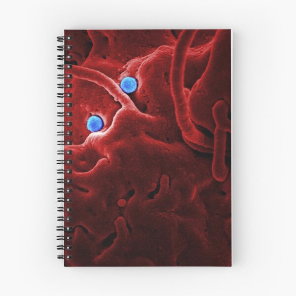 Item preview, STK701457H-MERS-CoV viral particles on the surface of a came epithelial cell. designed and sold by StocktrekImages.