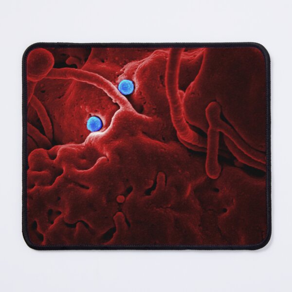 Item preview, STK701457H-MERS-CoV viral particles on the surface of a came epithelial cell. designed and sold by StocktrekImages.