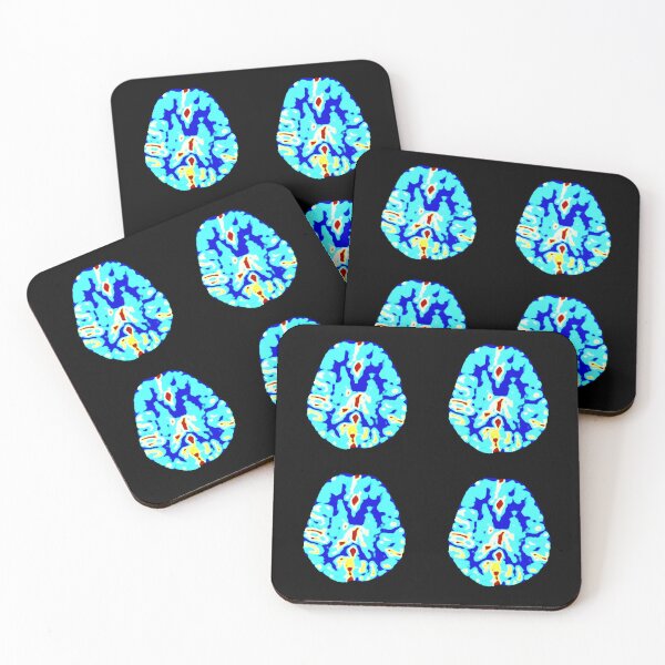 Item preview, Brain perfusion imaging study in multiple colors designed and sold by Creative Endeavors ..