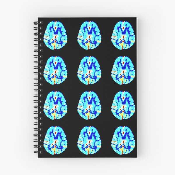Item preview, Brain perfusion imaging study in multiple colors designed and sold by Creative Endeavors ..