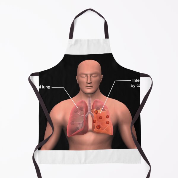 Item preview, STK701492H-COVID-19 coronavirus infecting the human lungs, with labels. designed and sold by StocktrekImages.