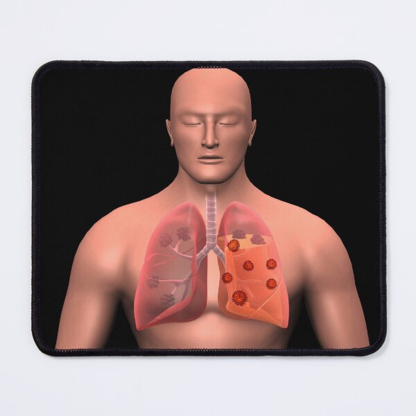 Item preview, STK701493H-COVID-19 coronavirus infecting the human lungs. designed and sold by StocktrekImages.