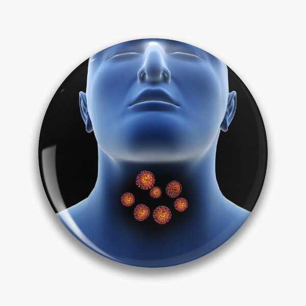 Item preview, STK701496H-Coronavirus in the human throat. designed and sold by StocktrekImages.