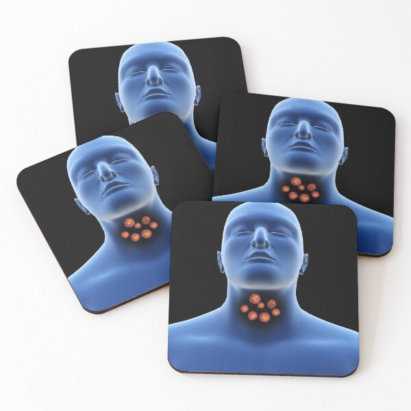 Item preview, STK701496H-Coronavirus in the human throat. designed and sold by StocktrekImages.