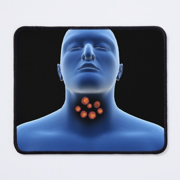 Item preview, STK701496H-Coronavirus in the human throat. designed and sold by StocktrekImages.