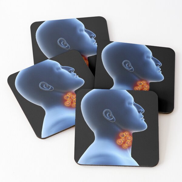 Item preview, STK701497H-Coronavirus in the human throat. designed and sold by StocktrekImages.